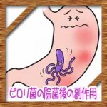ピロリ菌の除菌後の副作用!失敗はアルコール飲酒に喫煙?
