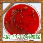 人食いバクテリアの予防対策※原因や初期症状に感染経路は?