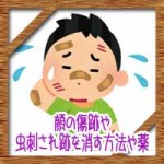 顔の傷跡や虫刺され跡を消す方法や薬!しこりの治療法は?
