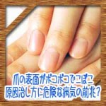 爪の表面がボコボコでこぼこ!原因治し方に危険な病気の前兆?